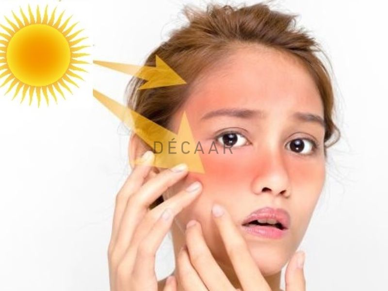 mụn trứng cá đỏ